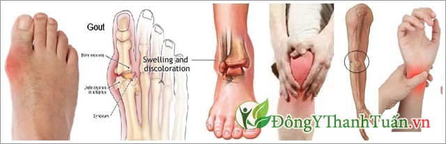 Cây nở ngày đất trị bệnh gout Cây nở ngày đất trị bệnh gout