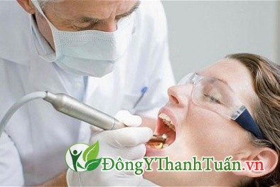 nguy cơ rụng răng vì bệnh viêm nha chu 3
