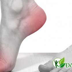 Bệnh thoái hóa khớp cổ chân và hướng điều trị