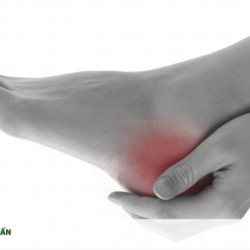 Đau gót chân là bệnh gì và những lựa chọn giảm đau hiệu quả