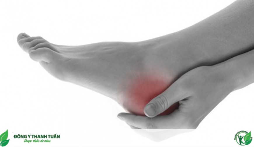 Đau gót chân là bệnh gì và những lựa chọn giảm đau hiệu quả