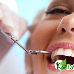 Biện pháp ngăn ngừa bệnh viêm lợi hiệu quả