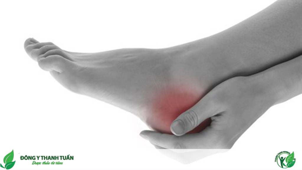 đau gót chân là bệnh gì