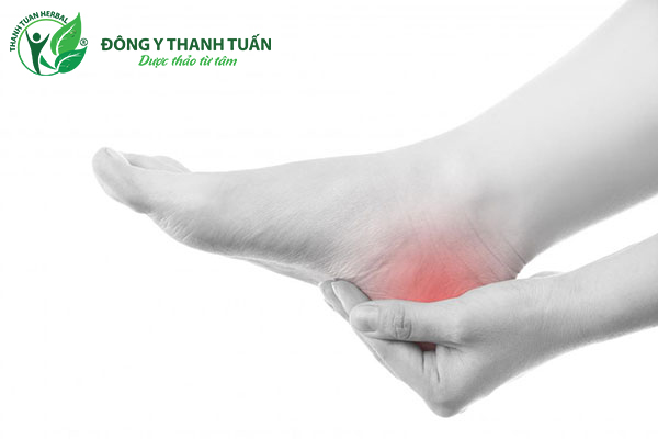 Plantar fasciitis là một nguyên nhân phổ biến của đau dưới gót chân.