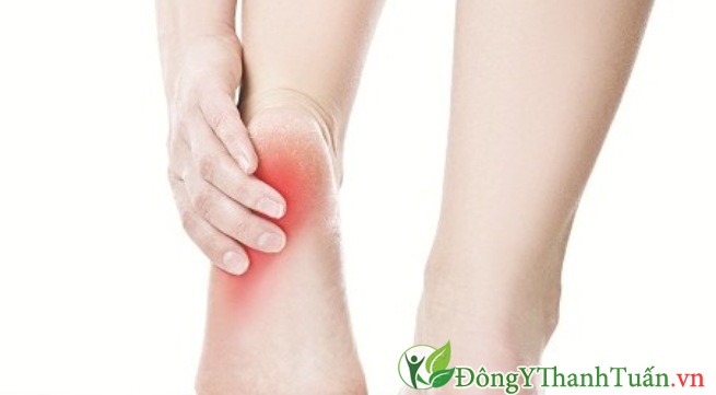 Bị đau gót chân là bệnh gì?