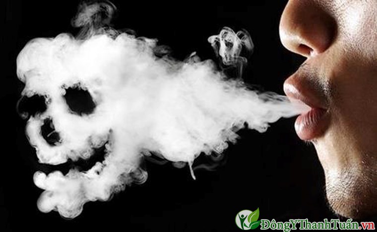 Hút thuốc lá là nguyên nhân gây hôi miệng
