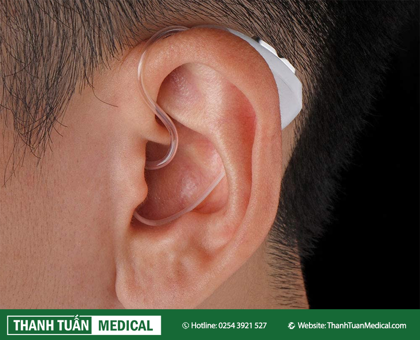 Máy trợ thính Biohealth JH-D59 đeo ở vành tai