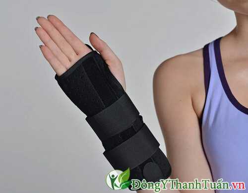 Nẹp cổ tay điều trị hội chứng de quervain