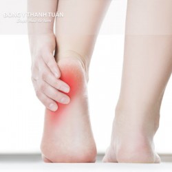 Bệnh gai gót chân có chữa được không?