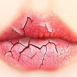 Bệnh tiểu đường: Khô miệng, khát nước nên điều trị khô miệng như thế nào hiệu quả?