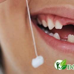 Cảnh báo nguy cơ rụng răng vì bệnh viêm nha chu