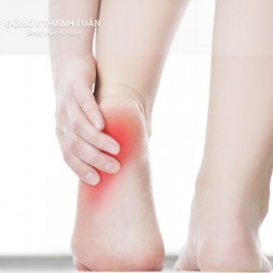 Đau xương gót chân là bệnh gì?