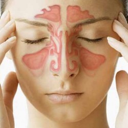Điều trị dứt điểm viêm mũi họng để phòng bệnh viêm xoang