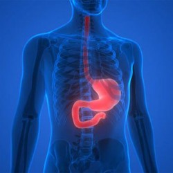 Làm gì để chống chứng trào ngược dạ dày?