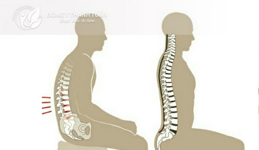 Mách bạn các cách trị đau lưng hiệu quả
