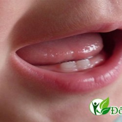 Nguyên nhân và cách điều trị trẻ bị viêm chân răng