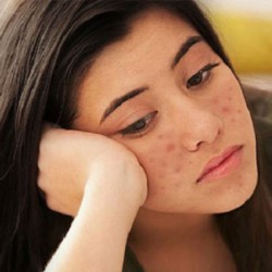 Nóng gan do đâu và điều trị như thế nào?