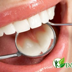 Tình cờ tôi đã khỏi bệnh đau răng